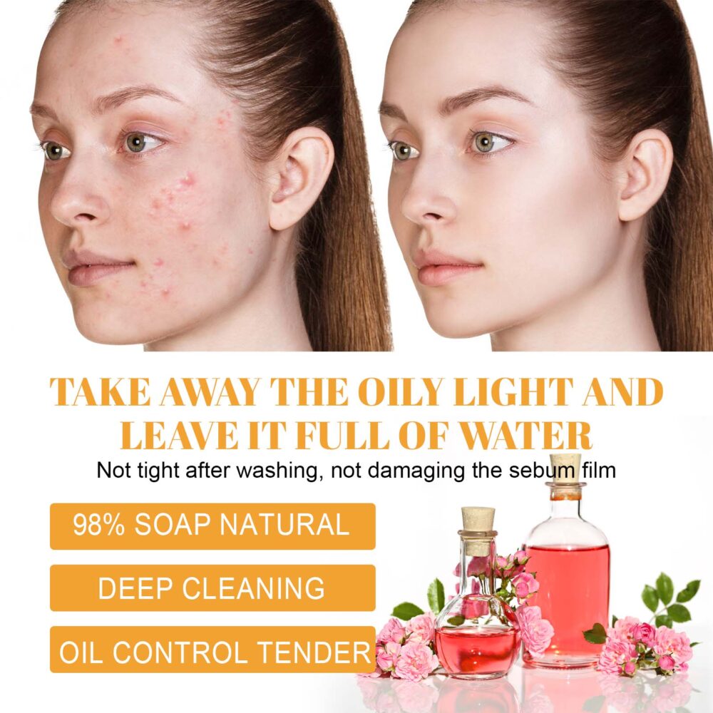 Turmeric Gentle Acne Cleansing Milk - Image 5