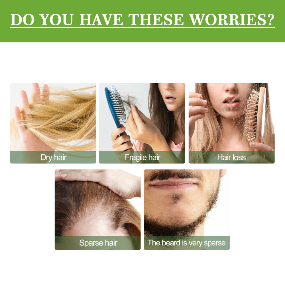 Rosemary hair care essential oil - Image 4