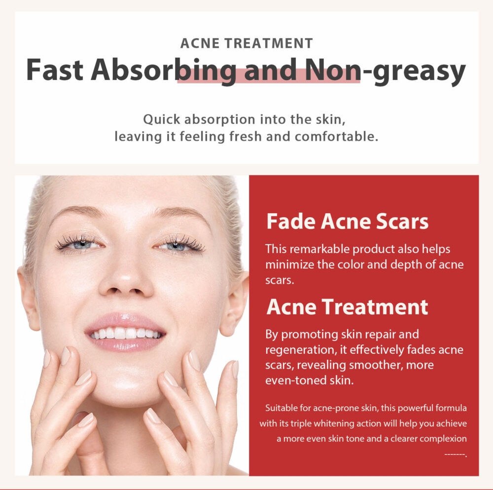 15% VC Acne Removing Niacinamide Black Spot Cream - Image 4