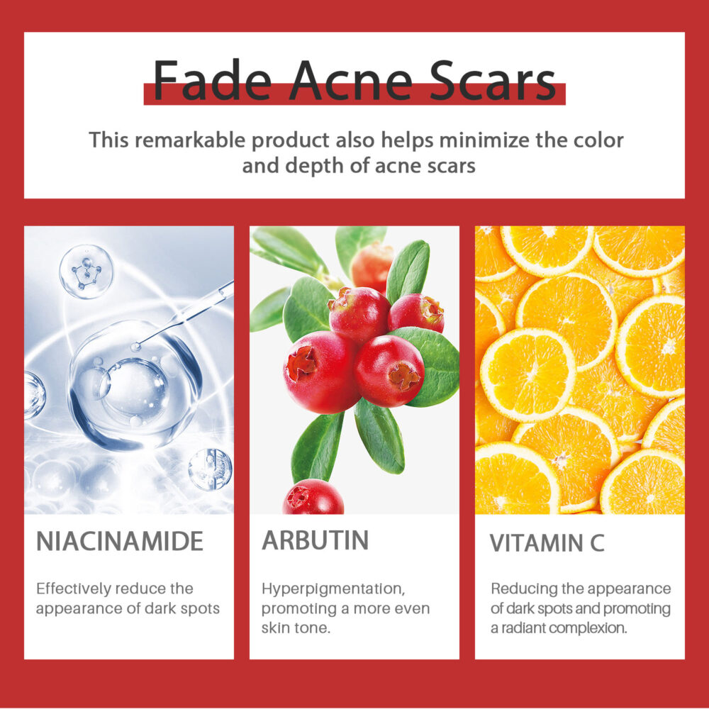 15% VC Acne Removing Niacinamide Black Spot Cream - Image 5