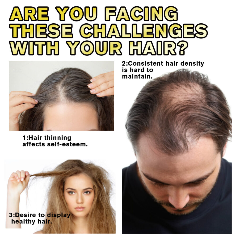 Minoxidil Hair essence - Image 3