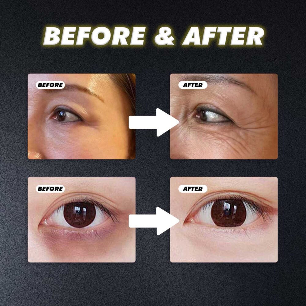 Turmeric Retinol Eye Cream Stick - Image 4