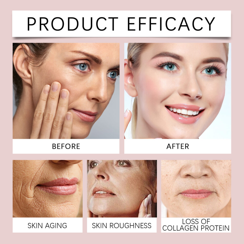 Brightening and Anti Wrinkle Spot Removing Cream - Image 5