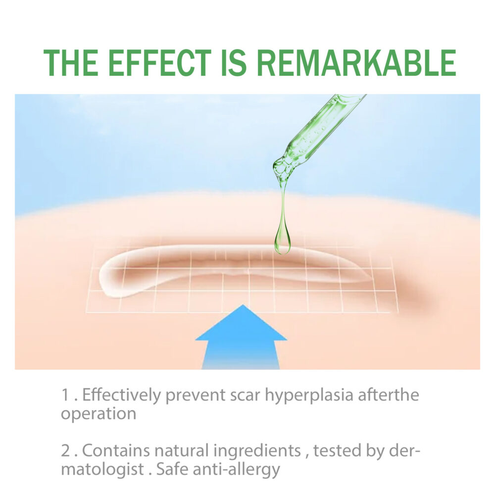 Scar skin repair essence - Image 5