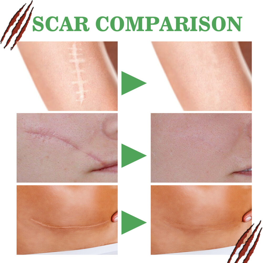 Scar skin repair essence - Image 6