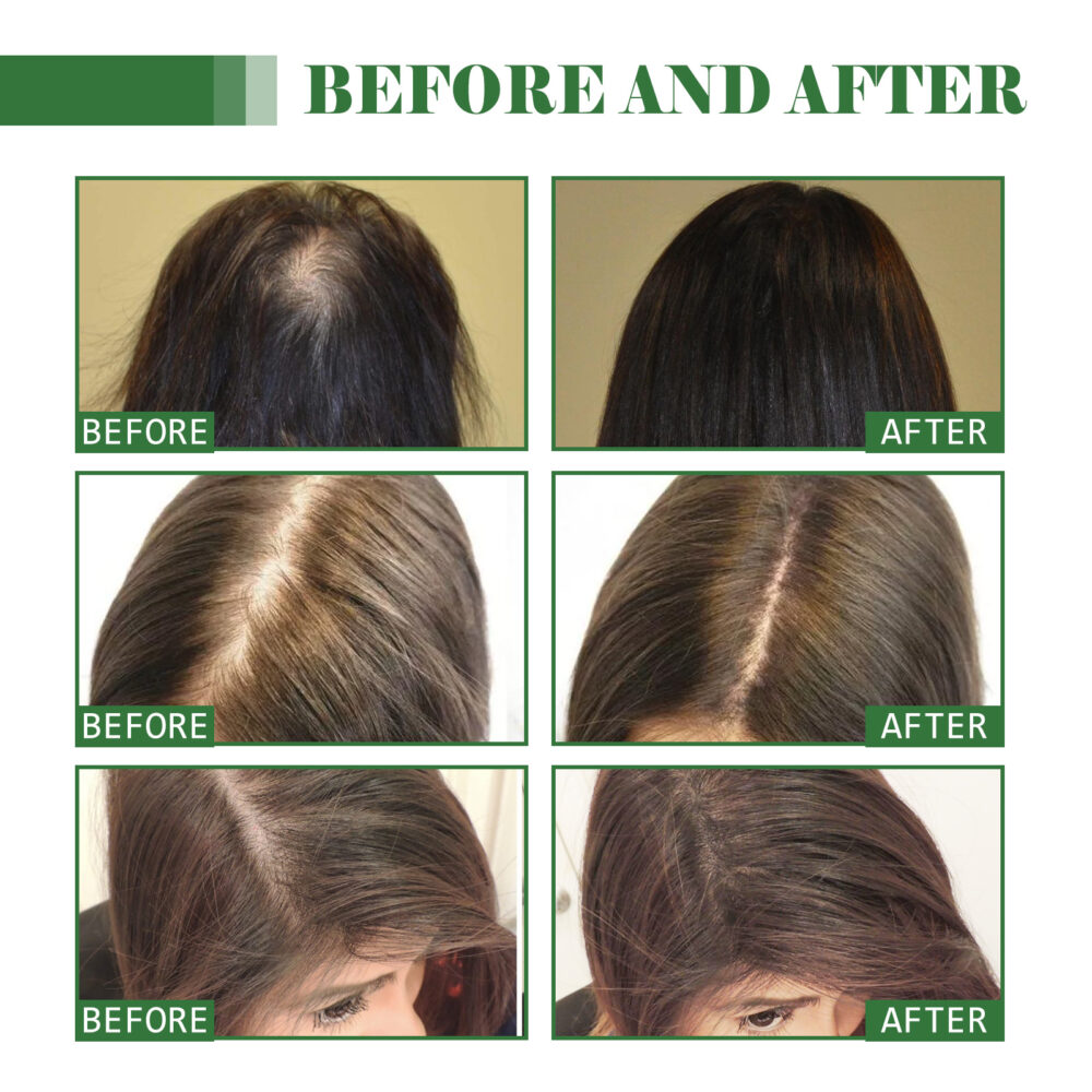 Batana Hair Growth Essential Oil - Image 3