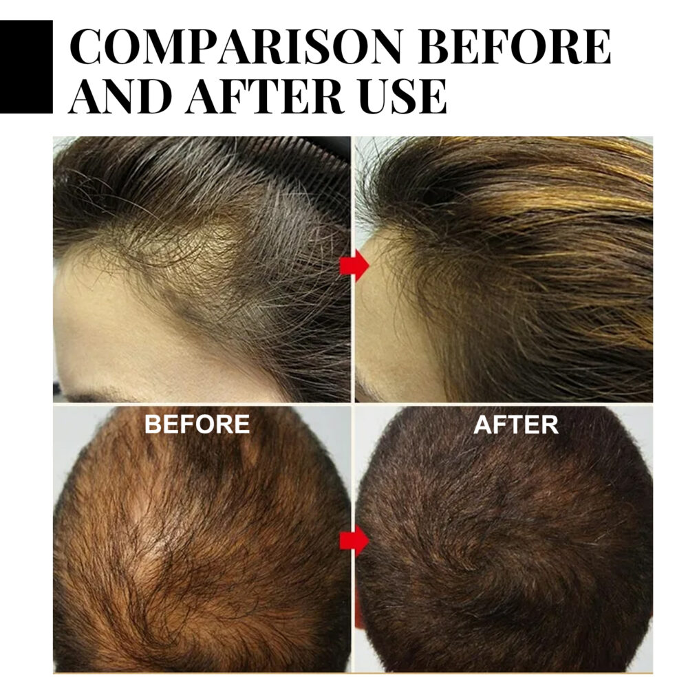 Batana dense hair spray - Image 5