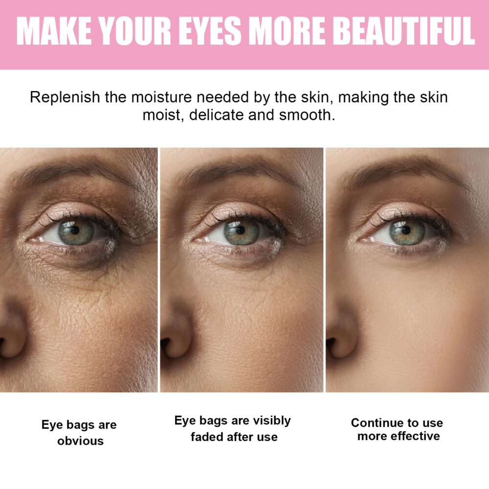 Sakura Eye Cream for Removing Dark Circles - Image 4