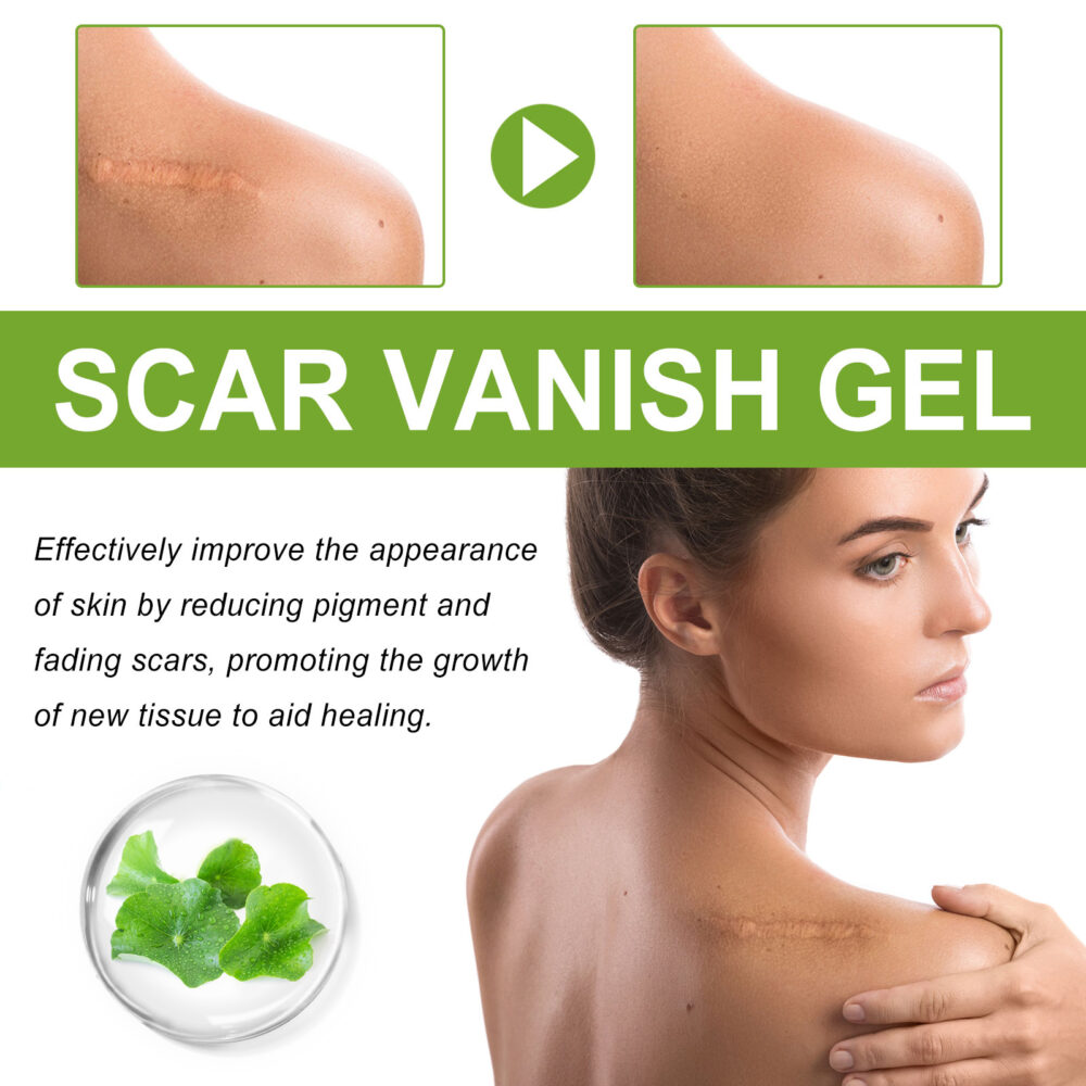 Salicylic acid scar removing gel - Image 3