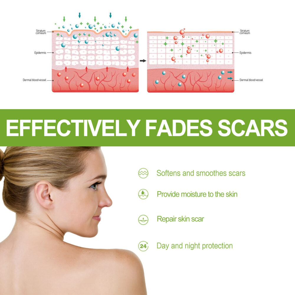 Salicylic acid scar removing gel - Image 4