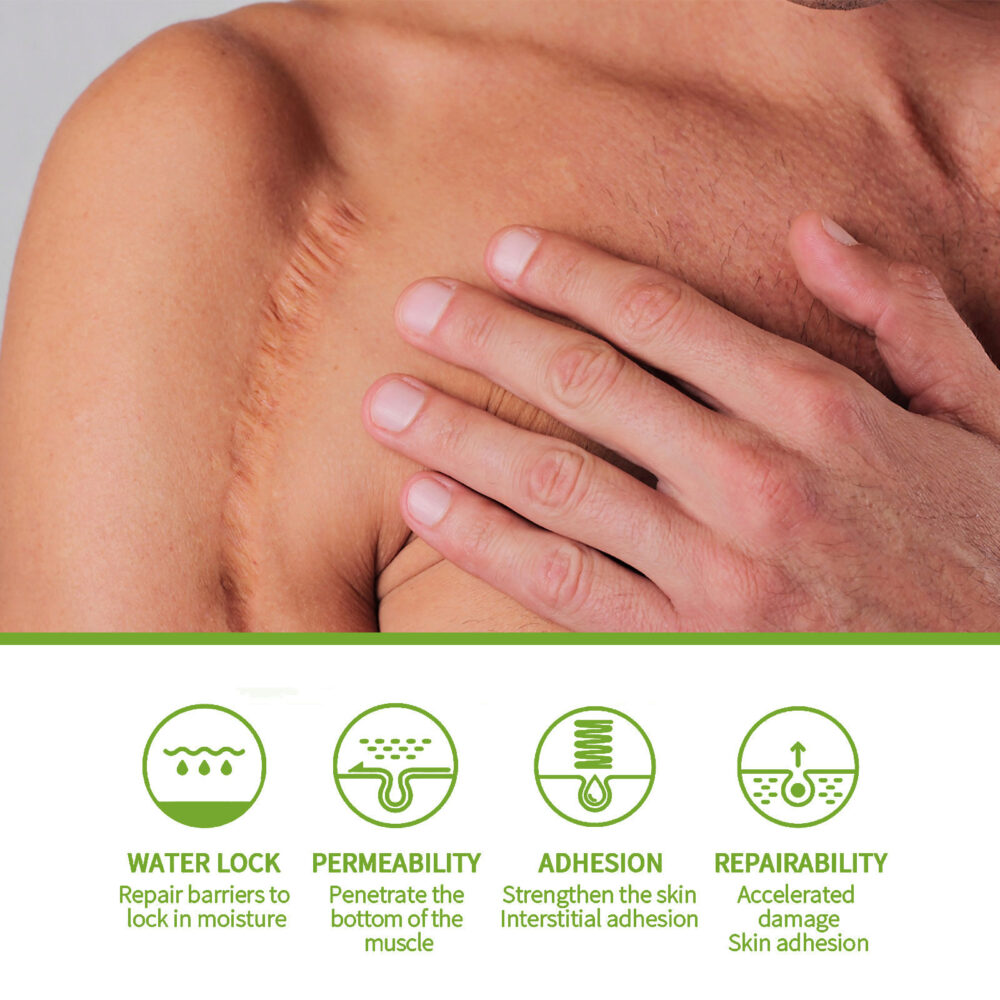 Salicylic acid scar removing gel - Image 5