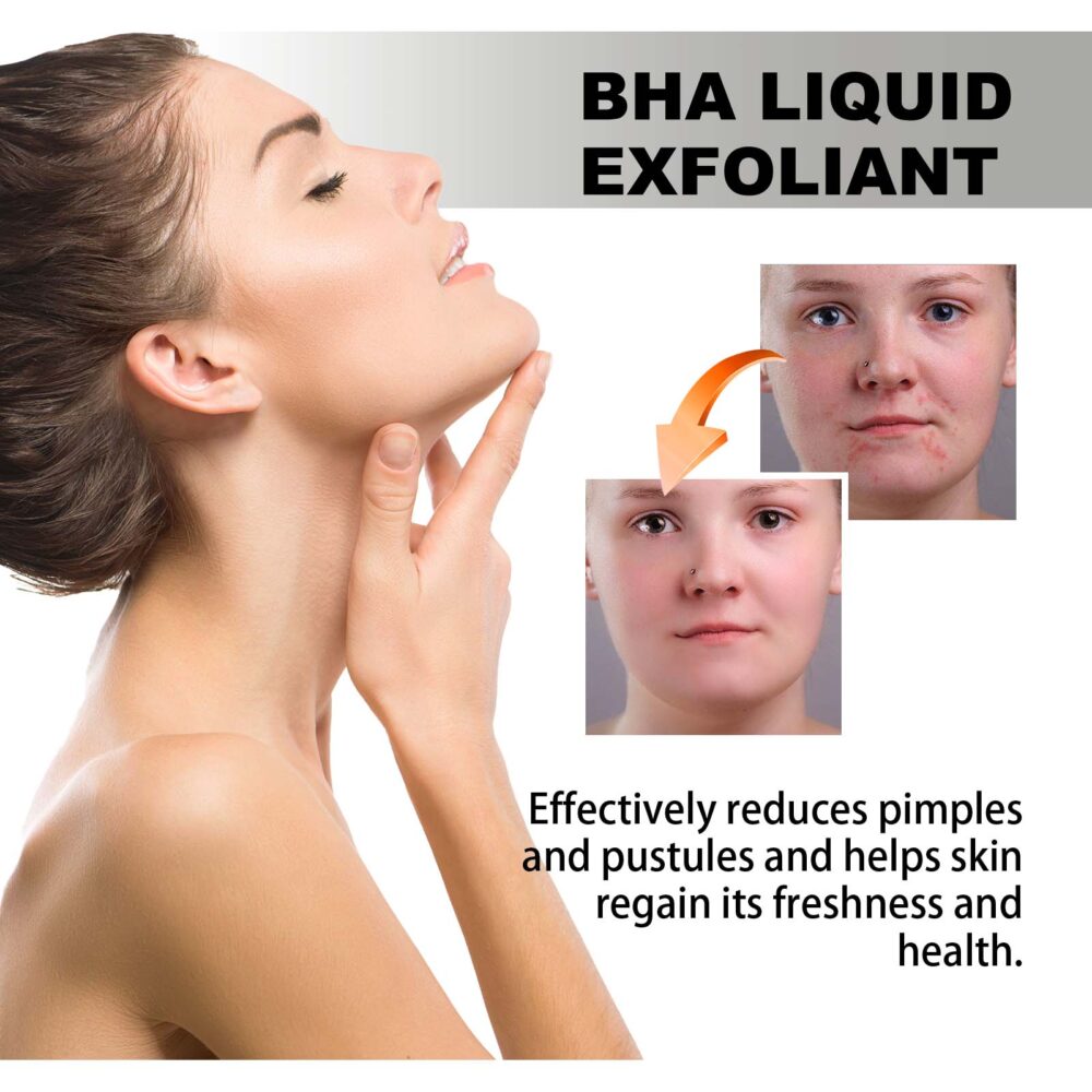 Salicylic Acid Acne Removing essence - Image 3