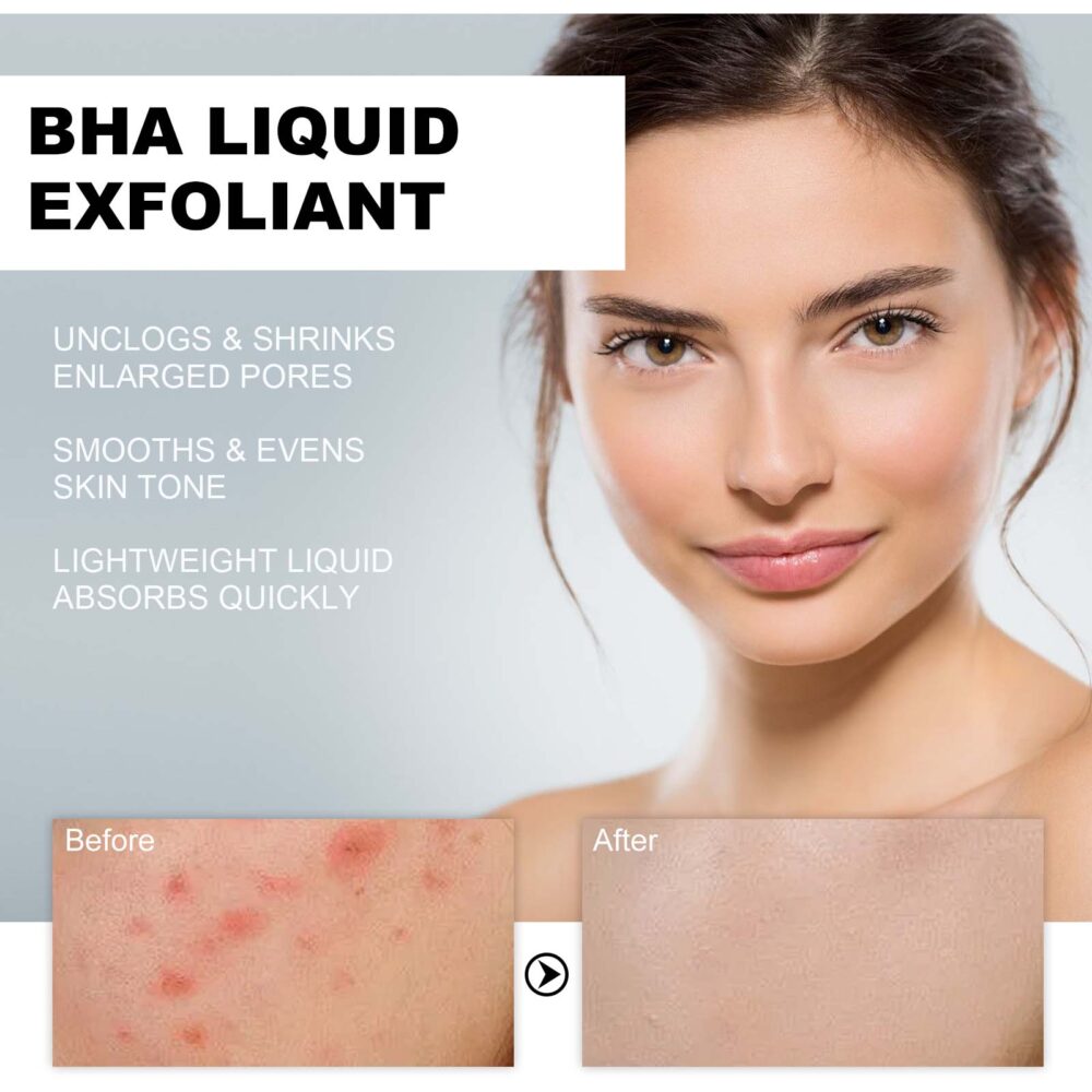 Salicylic Acid Acne Removing essence - Image 4
