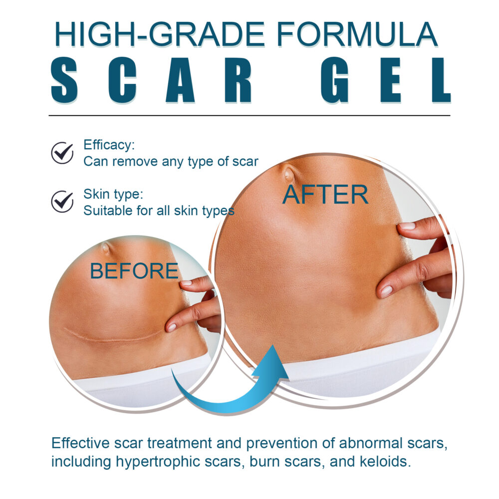 Desalination scar gel - Image 3