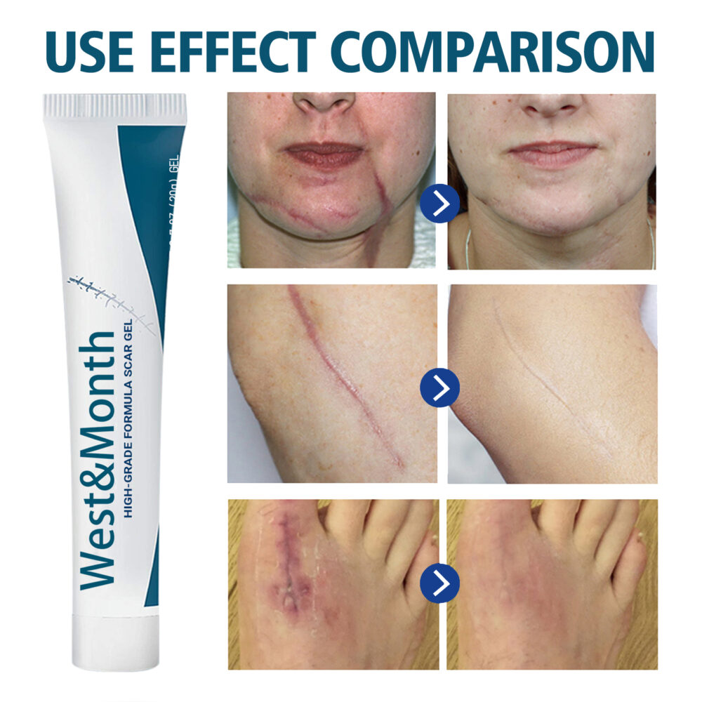 Desalination scar gel - Image 4