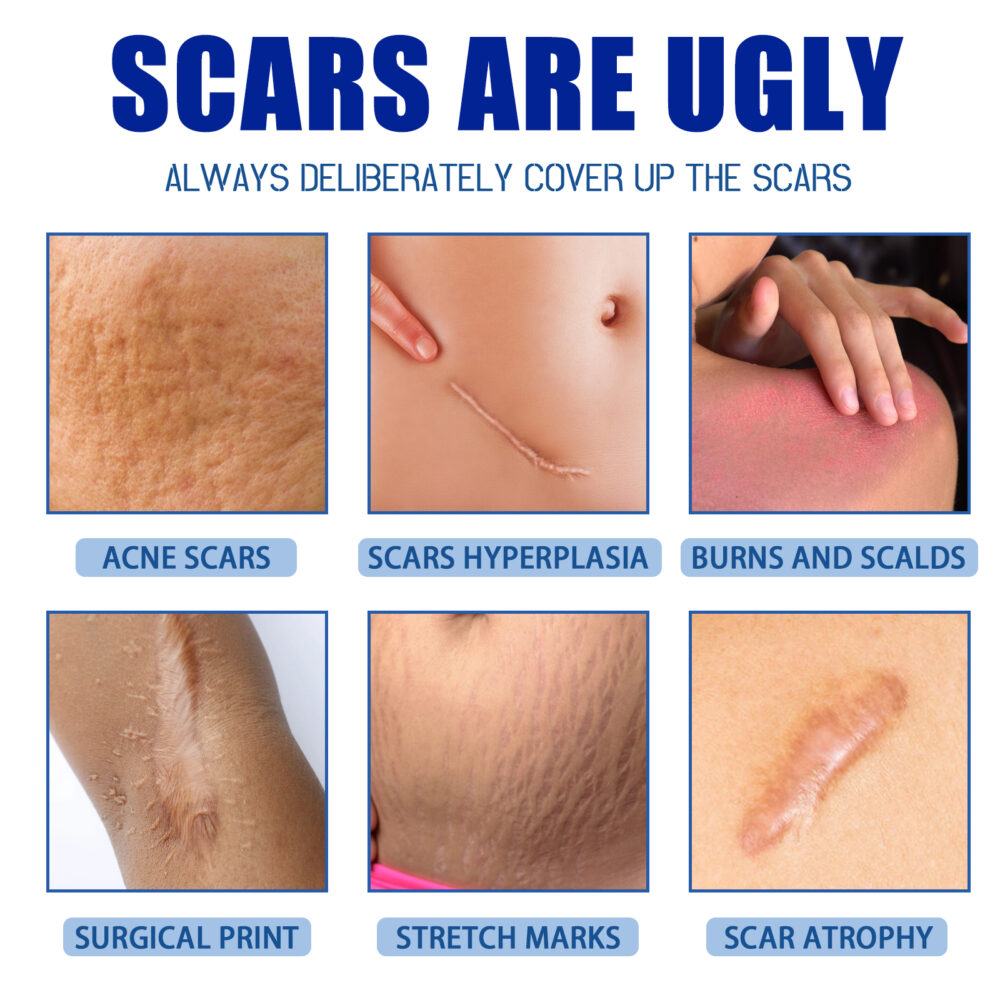 Light Scar Tightening Skin Repair Cream - Image 6