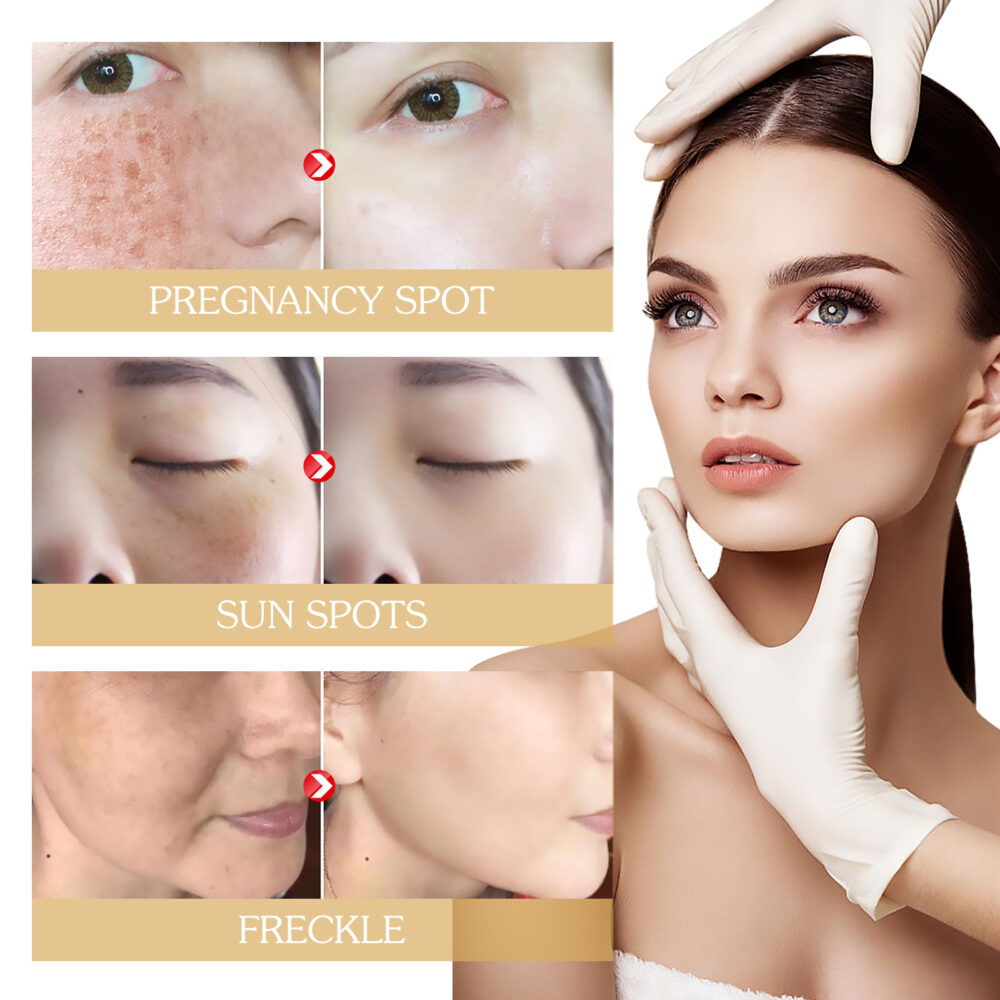 Arbutin whitening and brightening face cream - Image 5