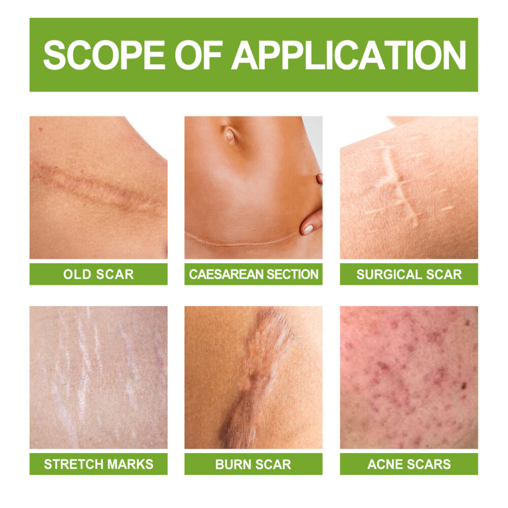 Scar repair essence - Image 3
