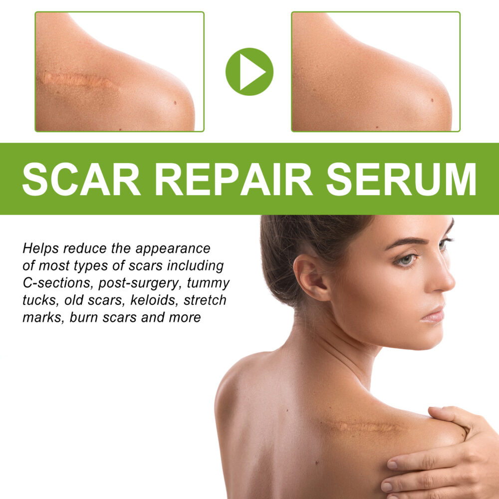 Scar repair essence - Image 4