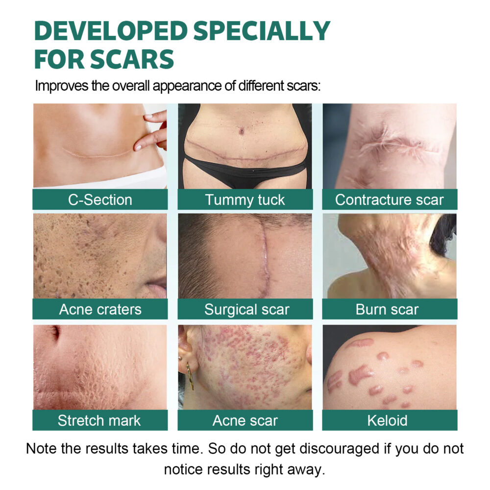 Scar gel 28g - Image 4