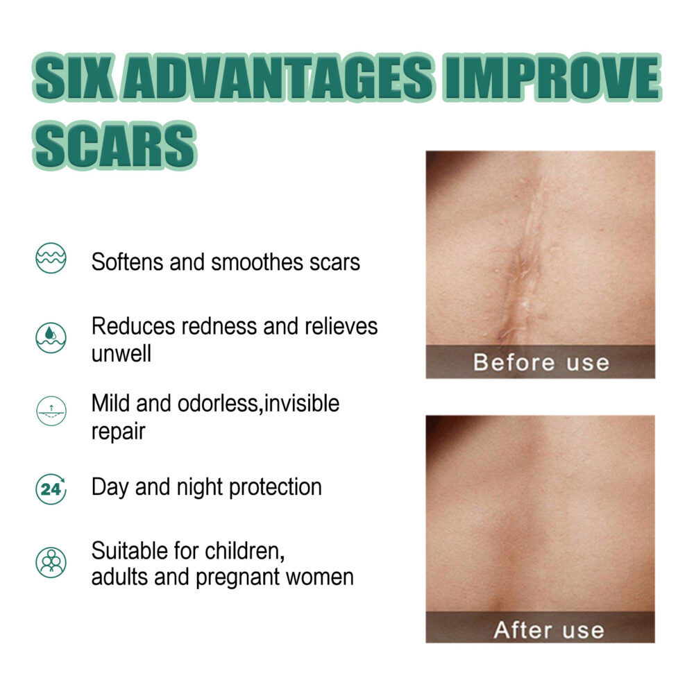 Scar gel 28g - Image 6