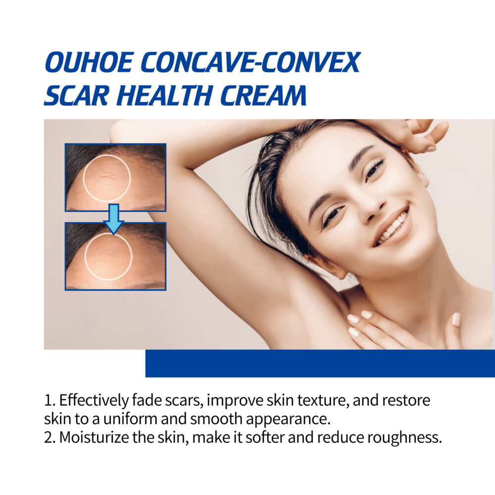 Scar Removal Cream - Image 4