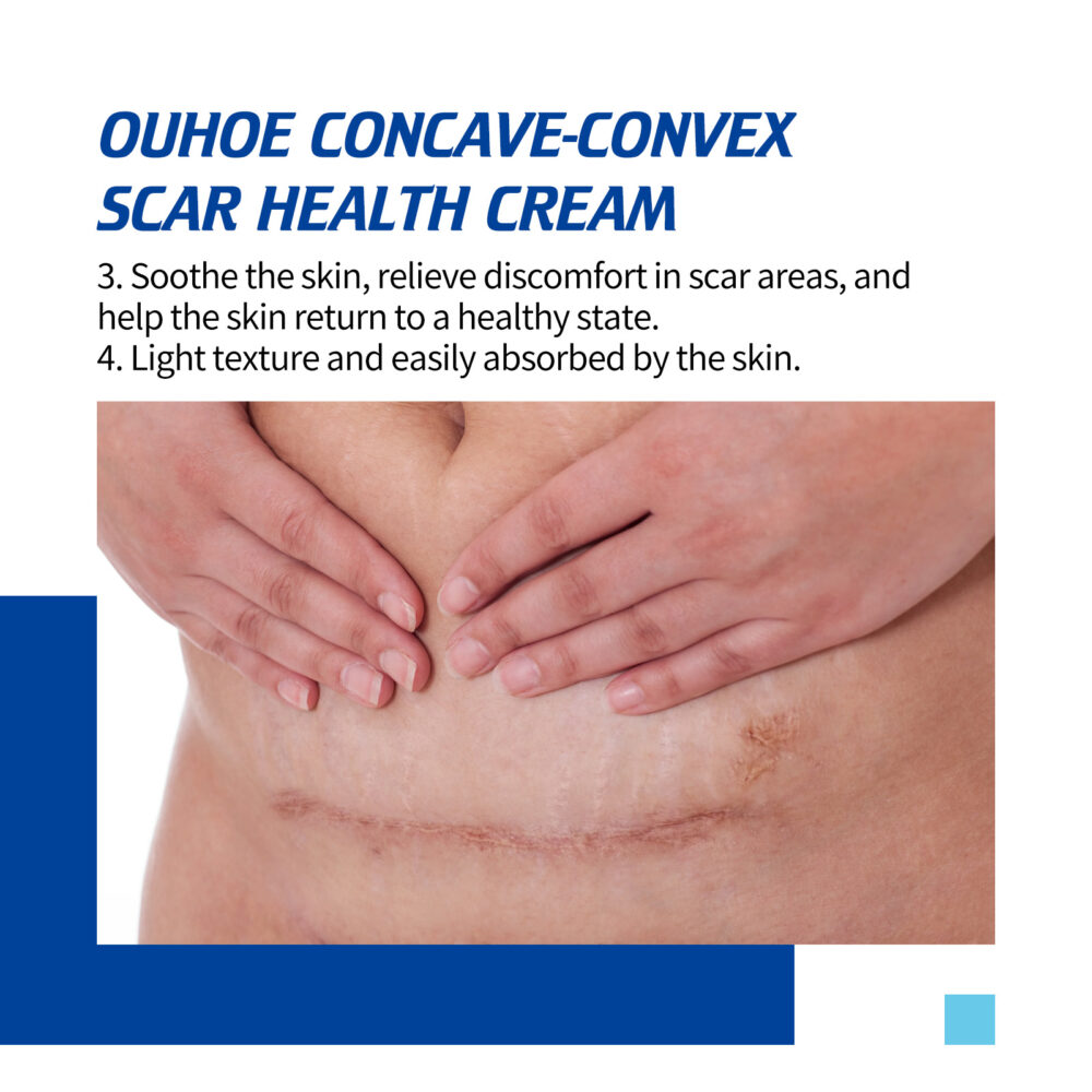 Scar Removal Cream - Image 5