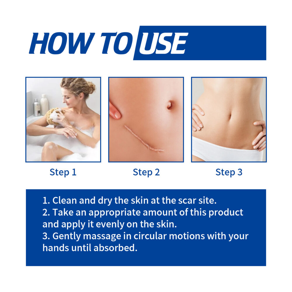 Scar Removal Cream - Image 6
