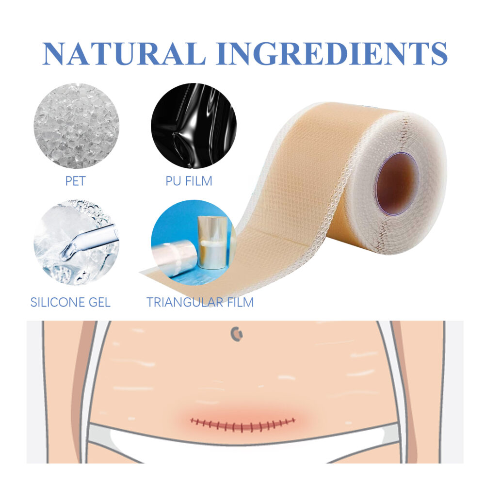 Silicone scar patch - Image 3