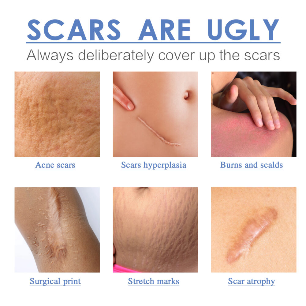 Silicone scar patch - Image 7