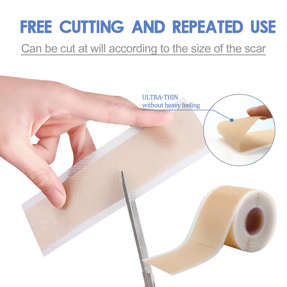 Silicone scar patch - Image 4