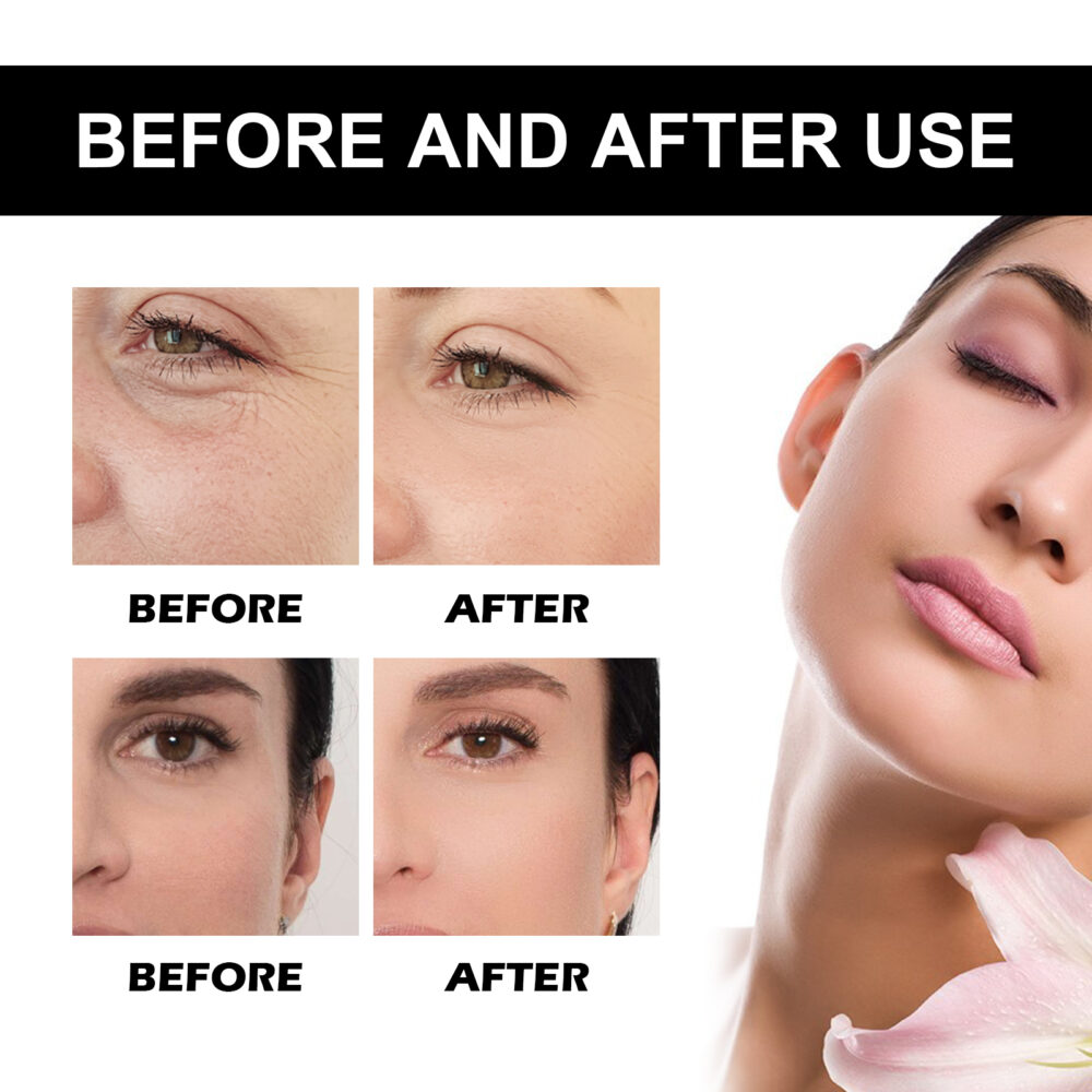Vitamin C Wrinkle Alleviating essence - Image 7