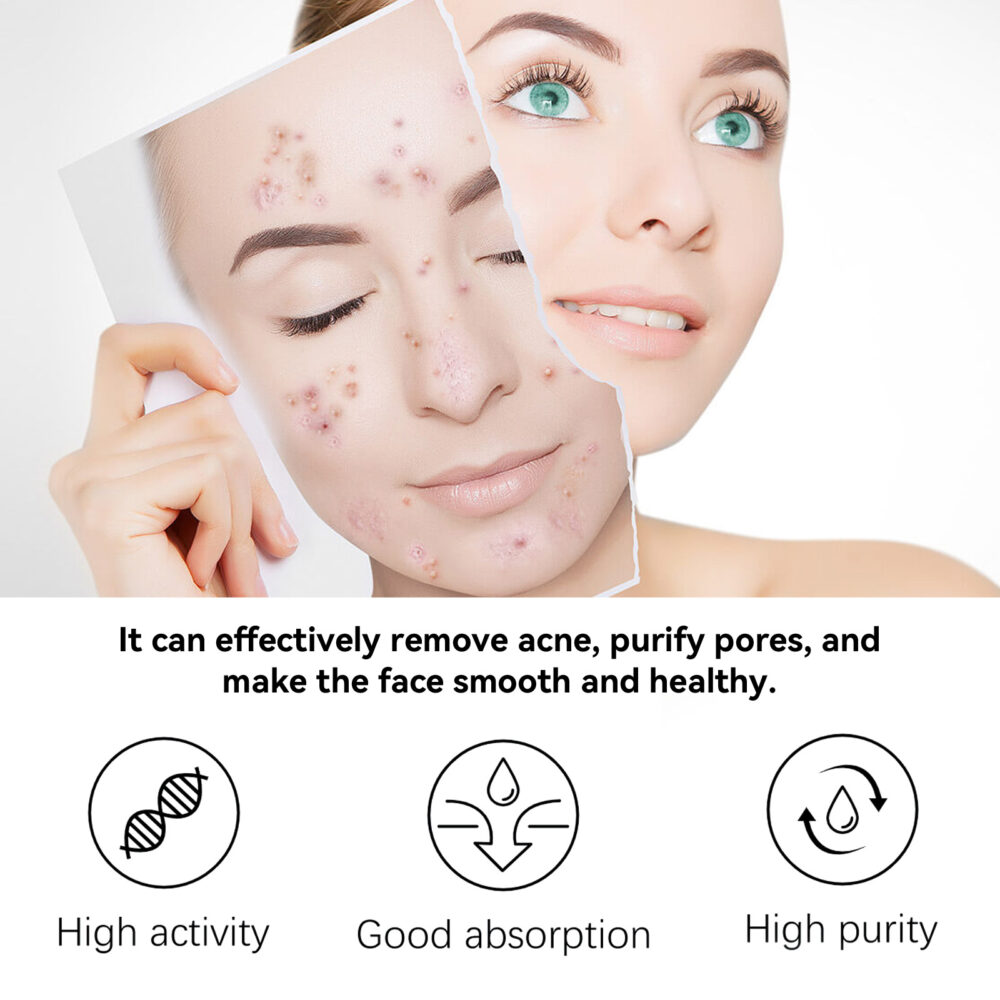 Tea herbal acne removing essence - Image 4