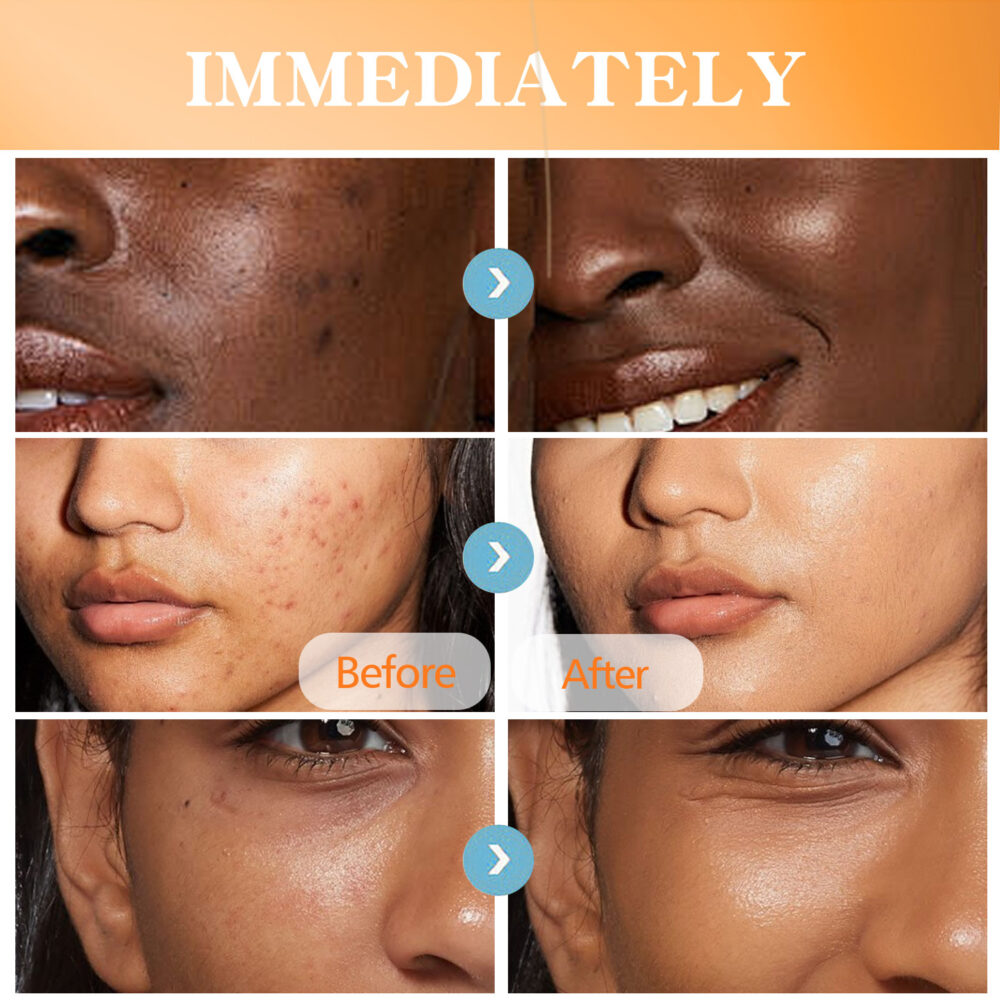 Turmeric body lotion - Image 6