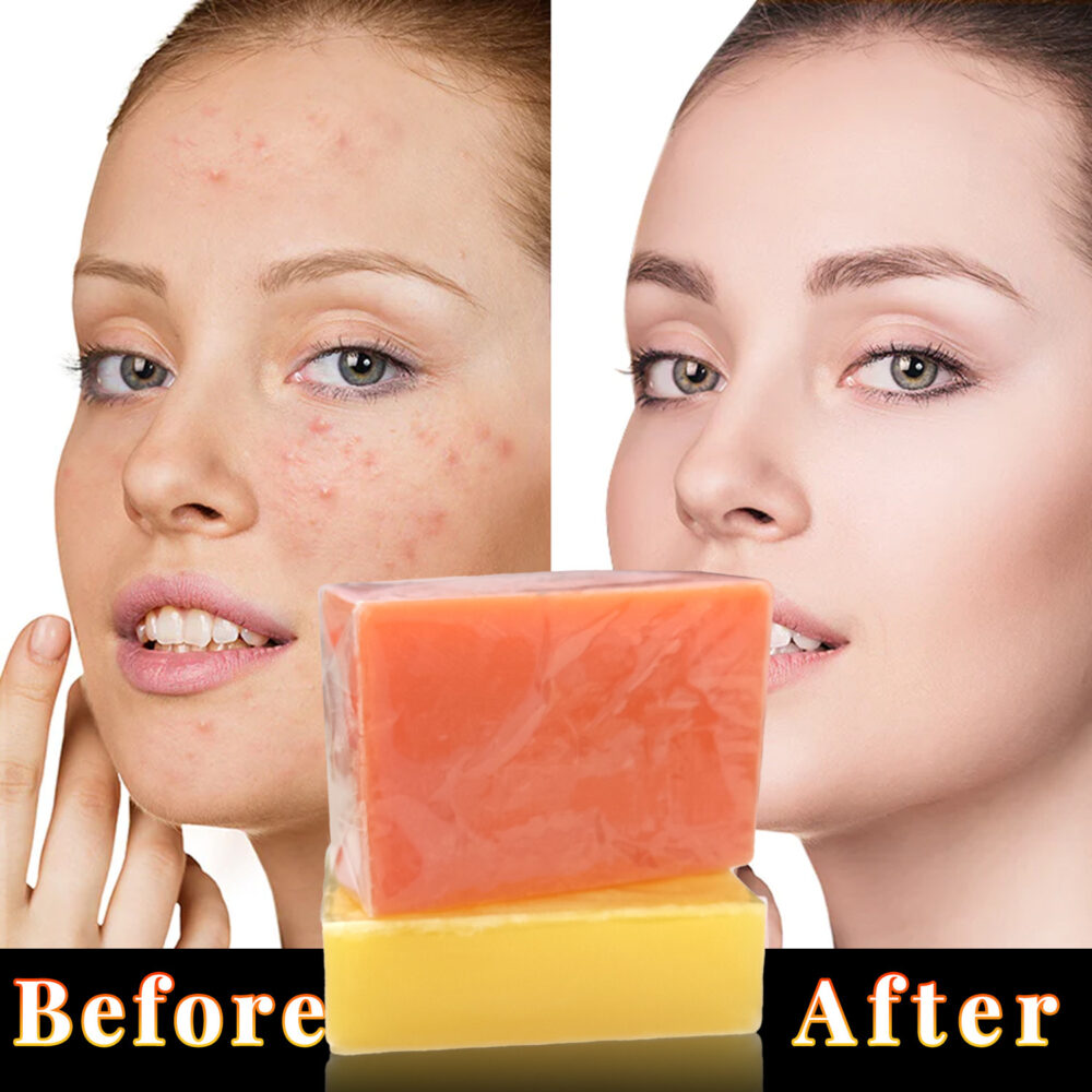 citric acid soap 100g（3 pieces） - Image 4