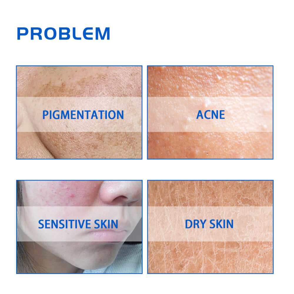Blueberry Anti aging Anti wrinkle Skin beautifying face cream - Image 5