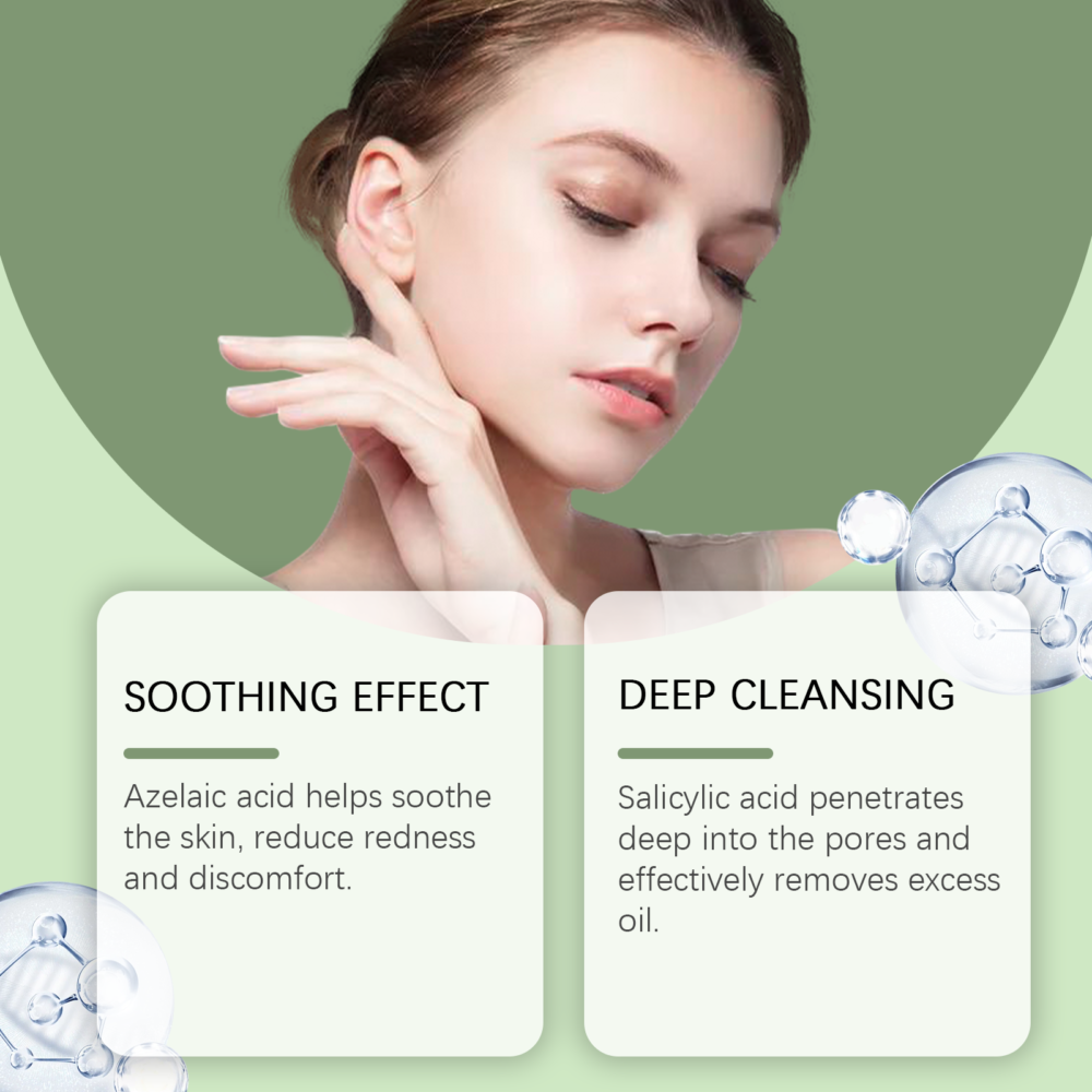 Mint Acne Cream - Image 2