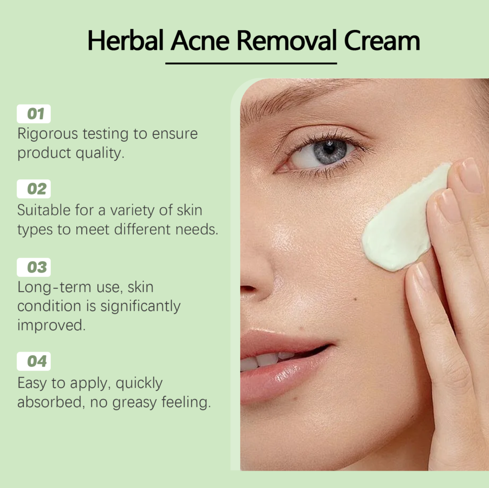 Mint Acne Cream - Image 3