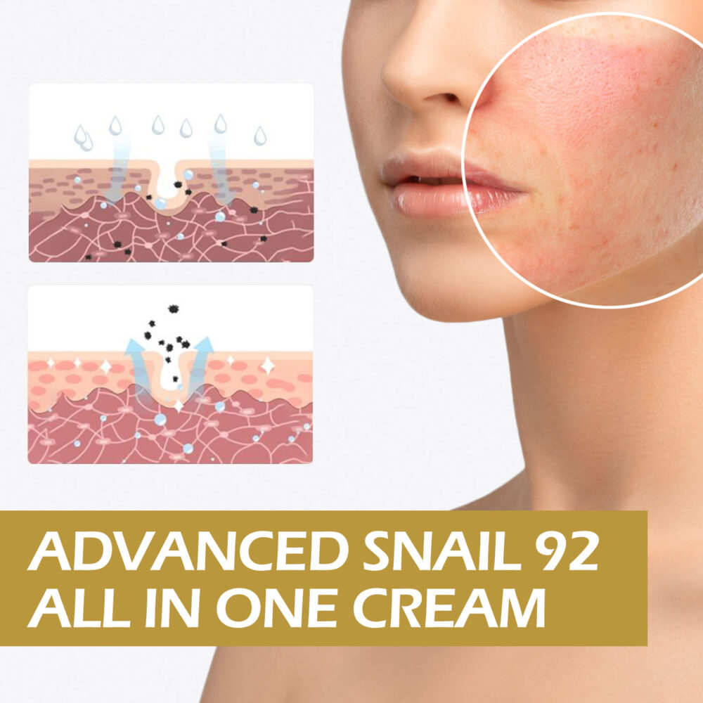 Snail 92 Repair Cream - Image 4