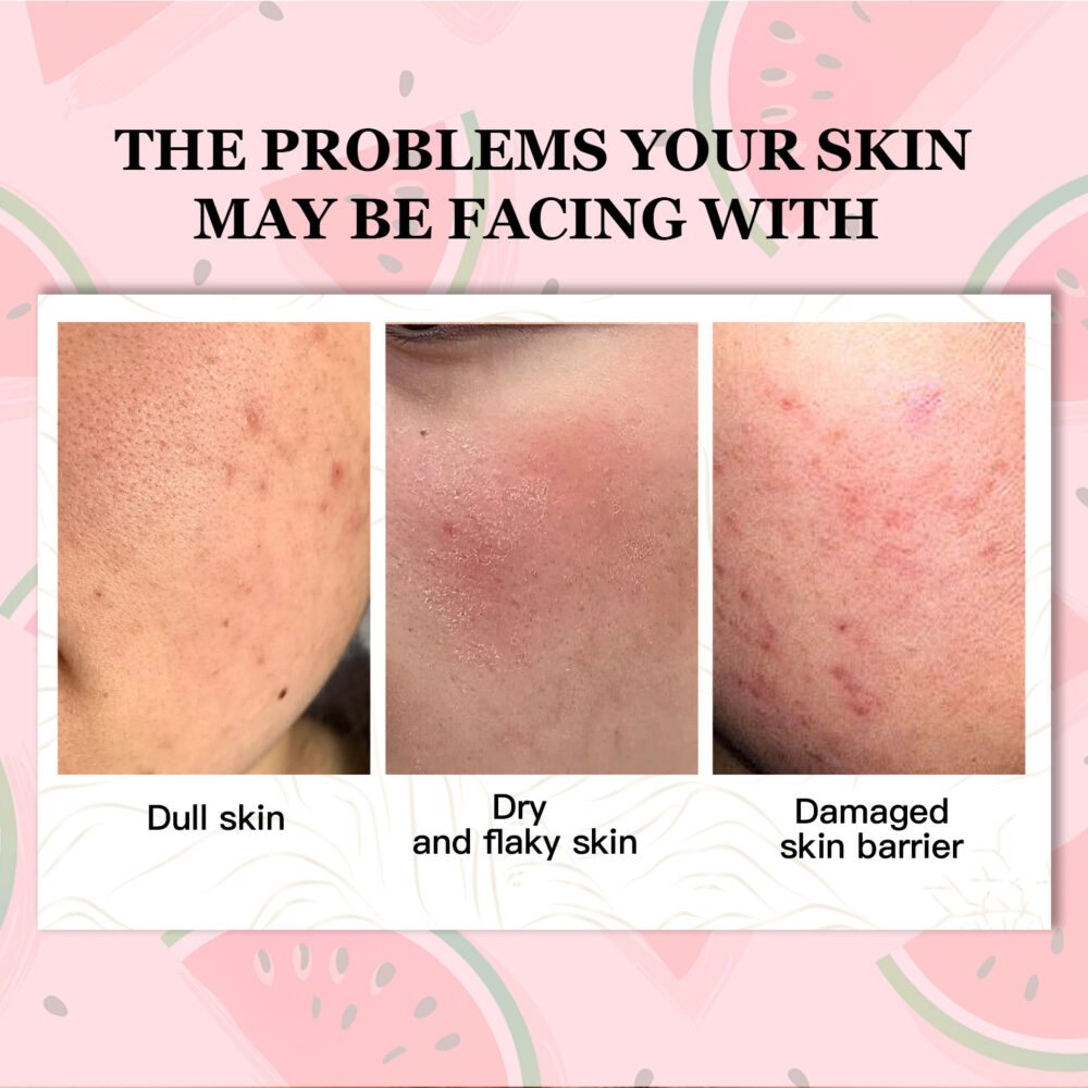 Watermelon Niacinamide Moisturizing essence - Image 3