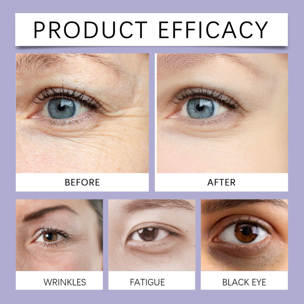 Retinol Moisturizing Eye Cream - Image 5
