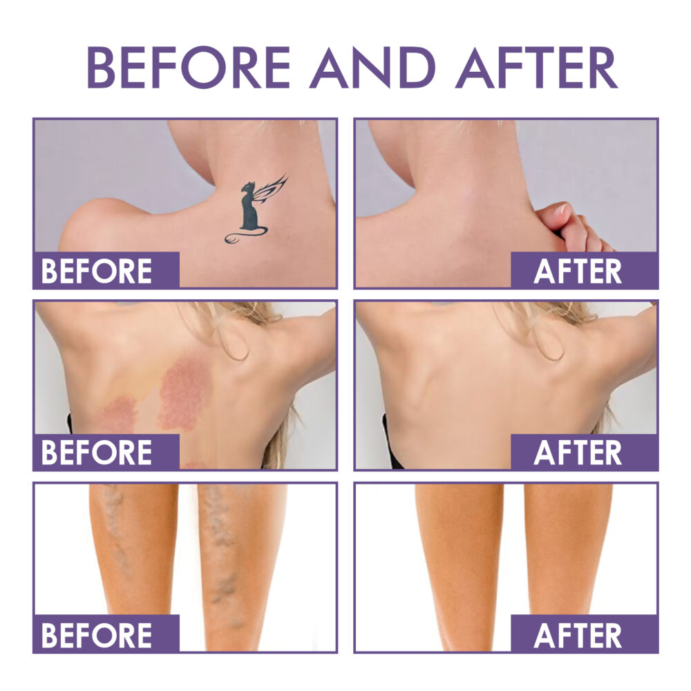 Body concealer Repair Cream - Image 4