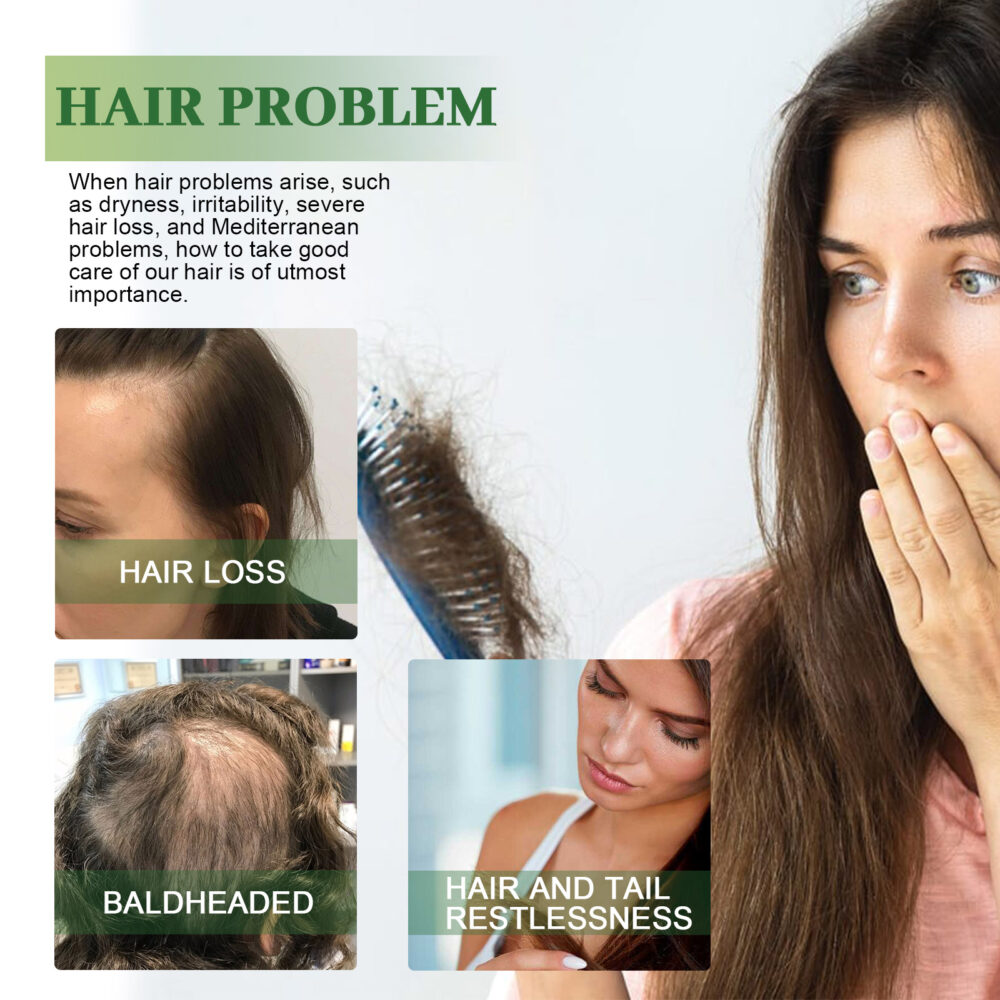 Rosemary hair care oil - Image 3