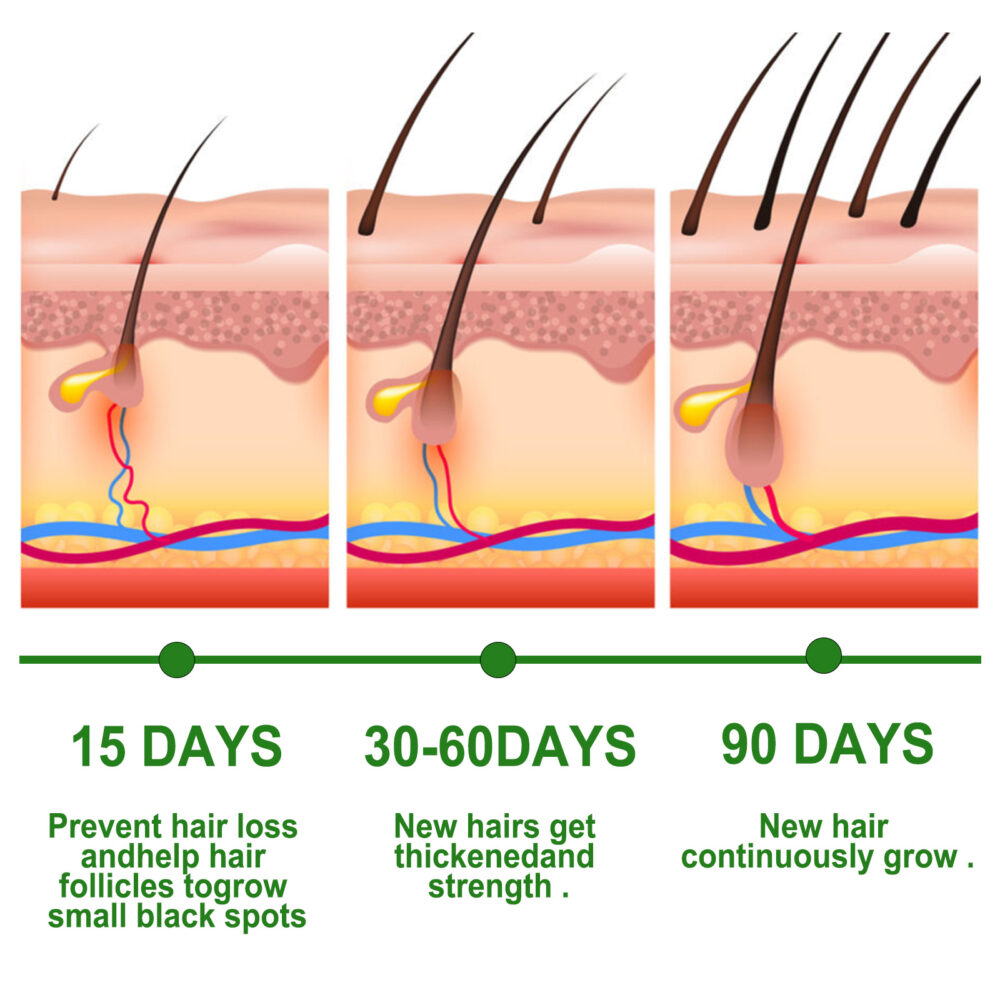 Rosemary hair care essential oil - Image 3
