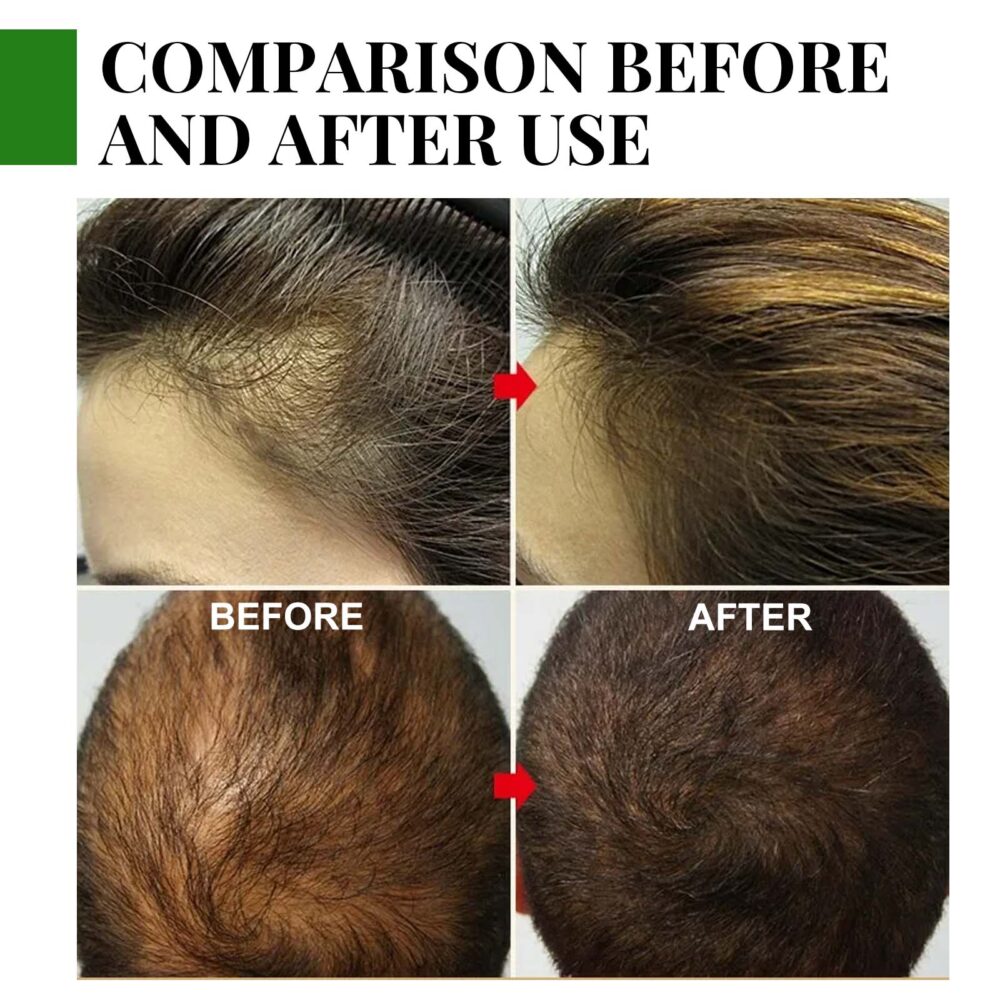 Rosemary Hair Care Capsules - Image 5