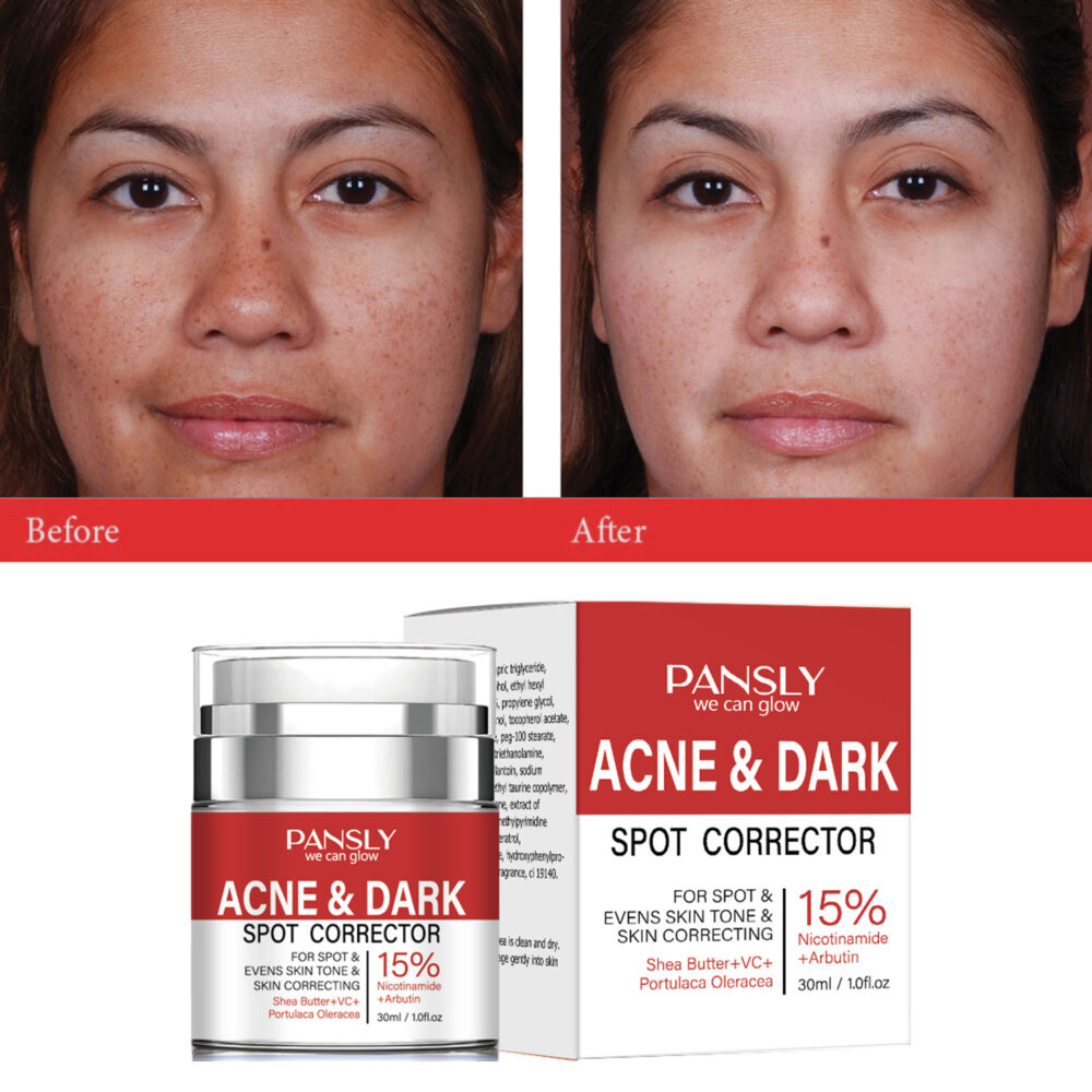 15% VC Acne Removing Niacinamide Black Spot Cream - Image 3