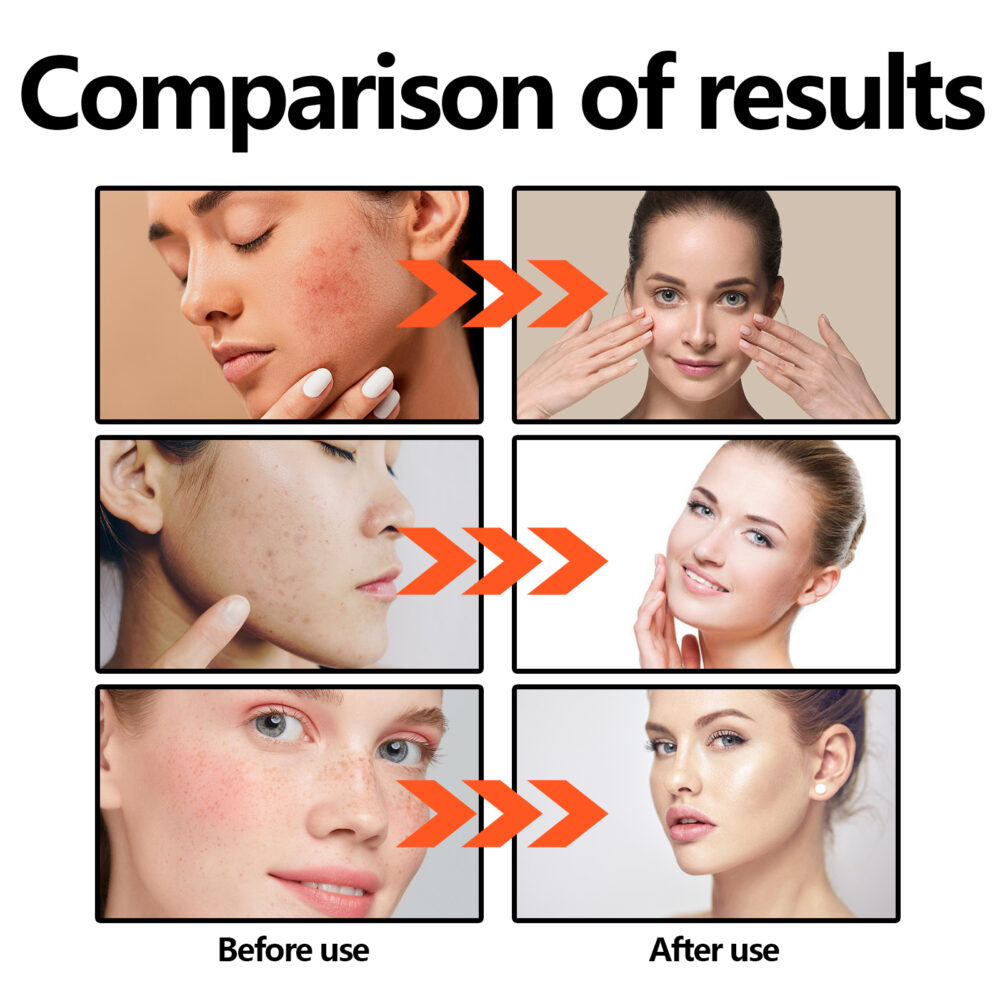 BHA2% Gentle Exfoliating Toner - Image 4