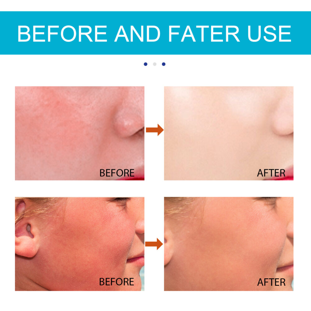 Moisturizing Sunscreen Stick - Image 5