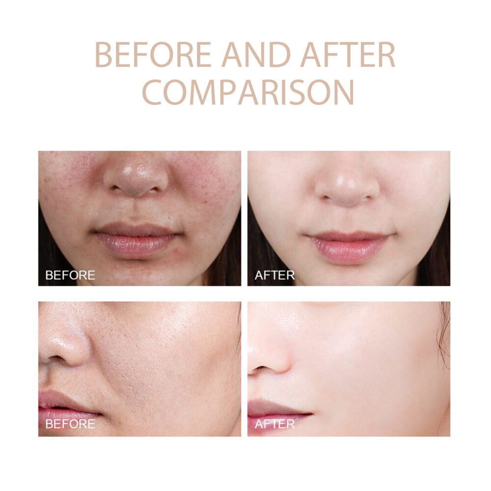 Purifying exfoliating gel - Image 3
