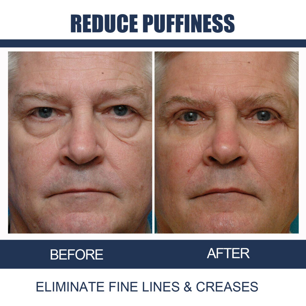 Peptide Eye gel - Image 6